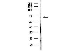 anti-Cysteine-Serine-Rich Nuclear Protein 3 (CSRNP3) (Internal Region) antibody