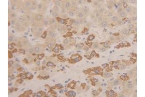 Detection of INHbC in Human Liver Tissue using Polyclonal Antibody to Inhibin Beta C (INHbC)