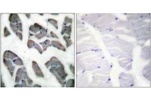 Immunohistochemistry analysis of paraffin-embedded human skeletal muscle tissue, using Actin-gamma2 Antibody.