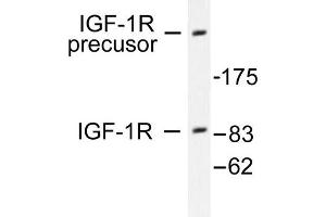 Image no. 1 for anti-Insulin-Like Growth Factor 1 Receptor (IGF1R) antibody (ABIN265475) (IGF1R anticorps)