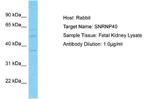 Host: Rabbit Target Name: SNRNP40 Sample Type: Fetal Kidney lysates Antibody Dilution: 1. (SNRNP40 anticorps  (Middle Region))