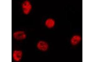 ABIN6278348 staining Hela by IF/ICC. (CHD5 anticorps  (Internal Region))
