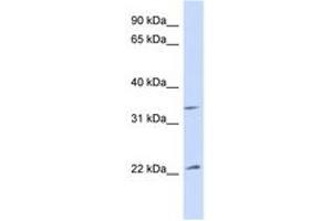 Image no. 1 for anti-ADP-Ribosylation Factor 1 (ARF1) (AA 73-122) antibody (ABIN6747229)