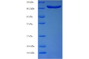 SDS-PAGE (SDS) image for Acyl-CoA Binding Domain Containing 5 (ACBD5) (AA 1-461), (partial) protein (His-SUMO Tag) (ABIN5711405)