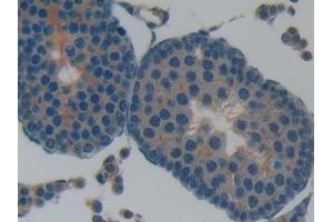 Detection of LIFR in Rat Testis Tissue using Polyclonal Antibody to Leukemia Inhibitory Factor Receptor (LIFR)