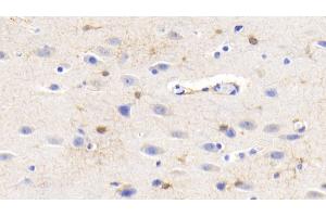 Detection of CK-BB in Human Cerebrum Tissue using Monoclonal Antibody to Creatine Kinase B (CK-BB)