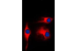 Immunofluorescent analysis of Gamma-enolase staining in K562 cells. (ENO2/NSE anticorps  (C-Term))