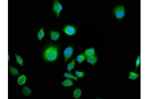 Immunofluorescence staining of A549 cells with ABIN7144052 at 1:100, counter-stained with DAPI. (ALS2CR12 anticorps  (AA 26-76))