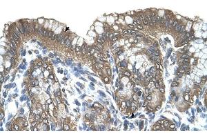 RARRES3 antibody was used for immunohistochemistry at a concentration of 4-8 ug/ml to stain Surface mucous cells and Epithelial cells of fundic gland (arrows) in Human Stomach. (RARRES3 anticorps)