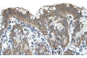 RARRES3 antibody was used for immunohistochemistry at a concentration of 4-8 ug/ml to stain Surface mucous cells and Epithelial cells of fundic gland (arrows) in Human Stomach.
