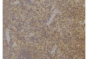 ABIN6259451 and ABIN6274942 at 1/100 staining Rat spleen tissue by IHC-P.