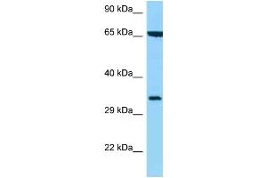 WB Suggested Anti-HLA-C Antibody Titration: 1. (HLA-C anticorps  (C-Term))