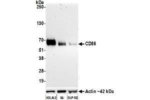 Western Blotting (WB) image for anti-CD86 (CD86) (AA 31-245) antibody (ABIN7453375)