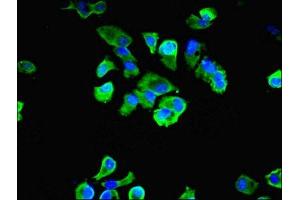 Immunofluorescent analysis of MCF-7 cells using ABIN7158439 at dilution of 1:100 and Alexa Fluor 488-congugated AffiniPure Goat Anti-Rabbit IgG(H+L)