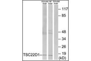 Western blot analysis of extracts from mouse liver/rat liver cells, using TSC22D1 Antibody . (TSC22D1 anticorps  (N-Term))