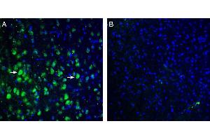 Expression of TRPM7 in rat parietal cortex.