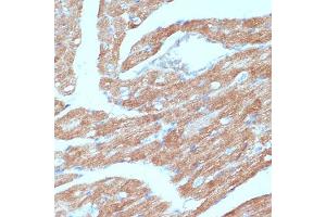 Immunohistochemistry of paraffin-embedded mouse heart using  antibody (ABIN6129863, ABIN6136456, ABIN6136457 and ABIN6215371) at dilution of 1:100 (40x lens). (Acsl3 anticorps  (AA 42-300))
