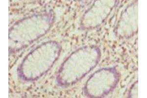 Immunohistochemistry of paraffin-embedded human testis tissue using ABIN7155301 at dilution of 1: 100 (HDAC1 anticorps  (AA 1-482))