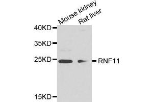 Western blot analysis of extract of mouse kidney and rat liver cells, using RNF11 antibody. (RNF11 anticorps)