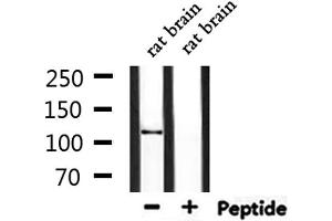 Western blot analysis of extracts from rat brain, using CEP110 Antibody. (Centriolin anticorps)