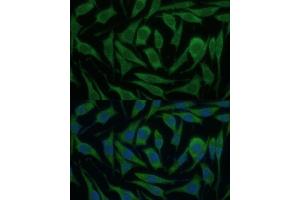 Immunofluorescence analysis of L929 cells using KIF14 Polyclonal Antibody (ABIN6129691, ABIN6142854, ABIN6142855 and ABIN6214465) at dilution of 1:100 (40x lens).