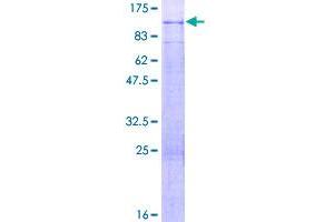 Image no. 1 for Podocan (PODN) (AA 1-661) protein (GST tag) (ABIN1315600)