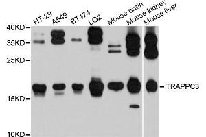 Western blot analysis of extracts of various cells, using TRAPPC3 antibody. (TRAPPC3 anticorps)