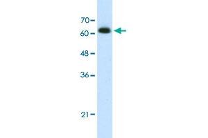 Western Blot analysis of Jurkat cell lysate with DIS3L2 polyclonal antibody  at 1. (DIS3L2 anticorps  (N-Term))