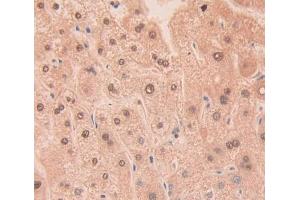 Used in DAB staining on fromalin fixed paraffin- embedded Kidney tissue