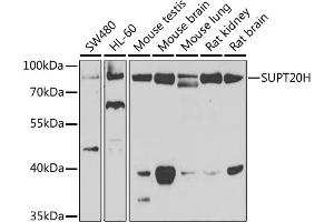Western blot analysis of extracts of various cell lines, using SUPT20H antibody (ABIN6133386, ABIN6148735, ABIN6148736 and ABIN6223233) at 1:1000 dilution.