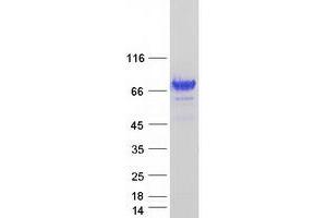 Validation with Western Blot