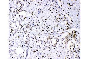 anti-Promyelocytic Leukemia (PML) (AA 141-179), (N-Term) antibody