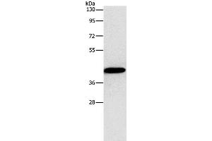 Western Blot analysis of MCF7 cell using Connexin-45 Polyclonal Antibody at dilution of 1:1250 (GJC1 anticorps)
