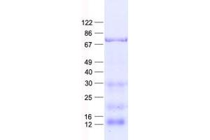Validation with Western Blot
