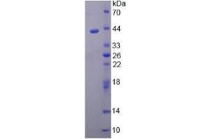 SDS-PAGE analysis of Human ARTN Protein. (ARTN Protéine)