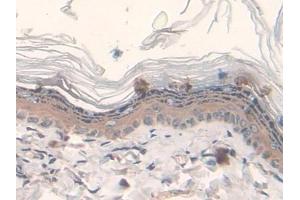 Detection of FASN in Rat Skin Tissue using Polyclonal Antibody to Fatty Acid Synthase (FASN)