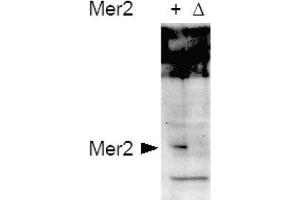 Image no. 1 for anti-CD151 (CD151) (AA 26-35), (pSer30) antibody (ABIN401337) (CD151 anticorps  (pSer30))