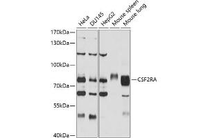 Western blot analysis of extracts of various cell lines, using CSF2RA antibody (ABIN3022748, ABIN3022749, ABIN1512778 and ABIN6219208) at 1:1000 dilution.