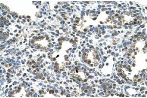 Immunohistochemical staining (Formalin-fixed paraffin-embedded sections) of human lung with GPNMB polyclonal antibody  at 4-8 ug/mL working concentration. (Osteoactivin anticorps  (N-Term))