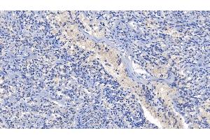 Detection of CDK1 in Human Spleen Tissue using Polyclonal Antibody to Cyclin Dependent Kinase 1 (CDK1)