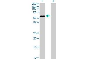 Western Blot analysis of ZNF565 expression in transfected 293T cell line by ZNF565 MaxPab polyclonal antibody. (ZNF565 anticorps  (AA 1-499))