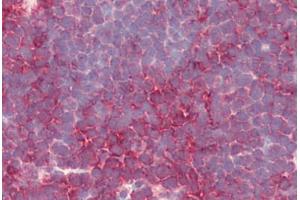 Human Thymus (formalin-fixed, paraffin-embedded) stained with PSENEN antibody ABIN461899 at 5 ug/ml followed by biotinylated goat anti-rabbit IgG secondary antibody ABIN481713, alkaline phosphatase-streptavidin and chromogen. (PEN2 anticorps  (N-Term))