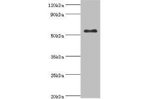 Western blot All lanes: Glucokinase antibody at 8 μg/mL + HepG2 whole cell lysate Secondary Goat polyclonal to rabbit IgG at 1/10000 dilution Predicted band size: 52 kDa Observed band size: 52 kDa (GCK anticorps  (AA 1-300))