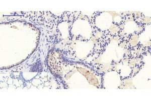 Immunohistochemistry of paraffin-embedded Rat lung tissue with Phospho-Stat1 (Tyr701) Polyclonal Antibody at dilution of 1:200