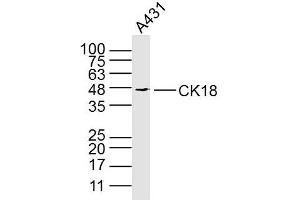 A431 cell lysates probed with KRT18 (3C3) Monoclonal Antibody, unconjugated (bsm-33101M) at 1:300 overnight at 4°C followed by a conjugated secondary antibody for 60 minutes at 37°C.