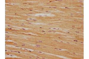 IHC image of ABIN7165960 diluted at 1:100 and staining in paraffin-embedded human heart tissue performed on a Leica BondTM system.