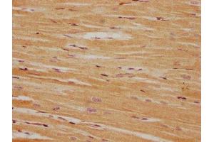 IHC image of ABIN7165960 diluted at 1:100 and staining in paraffin-embedded human heart tissue performed on a Leica BondTM system. (PPM1L anticorps  (AA 128-343))