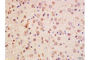 Formalin-fixed and paraffin embedded rat brain labeled with Anti-Erbin Polyclonal Antibody, Unconjugated  at 1:200 followed by conjugation to the secondary antibody and DAB staining. (ERBB2IP anticorps  (AA 21-120))