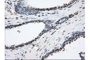 Image no. 12 for anti-Acetyl-CoA Acetyltransferase 2 (ACAT2) antibody (ABIN1496398)