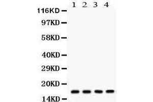 Western Blotting (WB) image for anti-Stathmin 1 (STMN1) (AA 2-34), (N-Term) antibody (ABIN3043301) (Stathmin 1 anticorps  (N-Term))